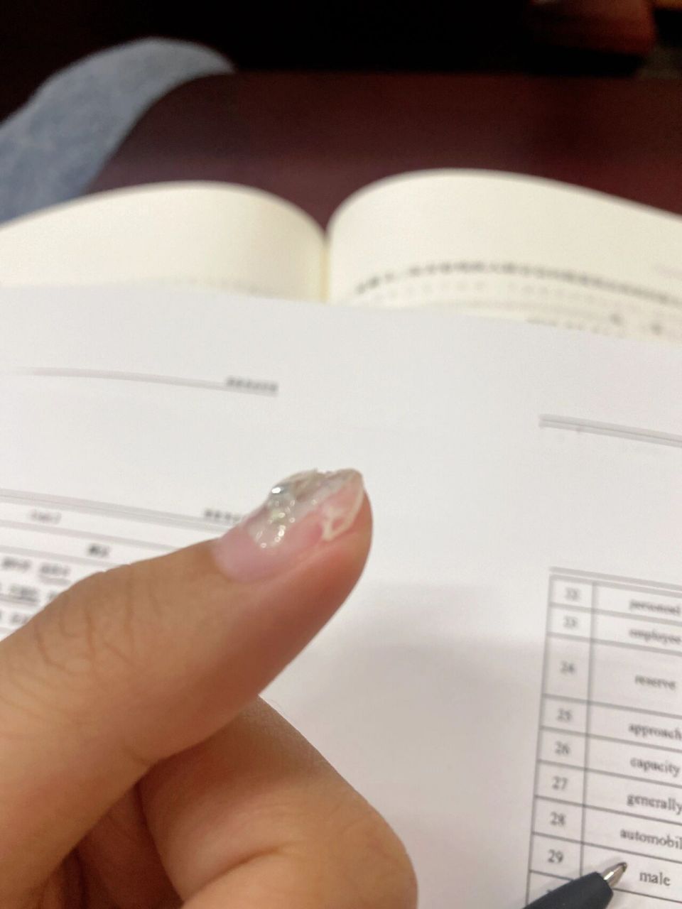 指甲在肉里劈了,还能做美甲吗?