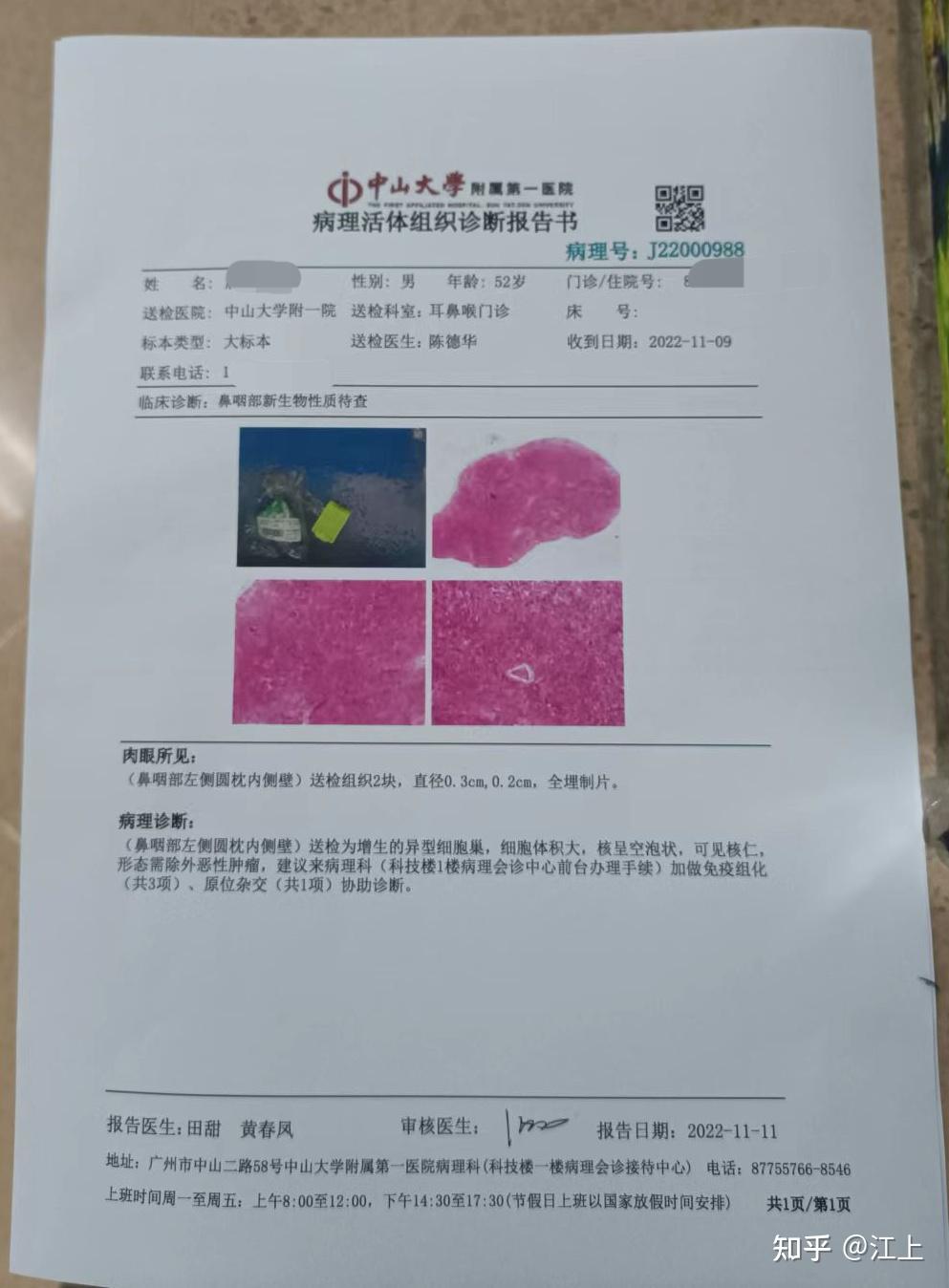 陪护父亲鼻咽癌初期治疗过程记录