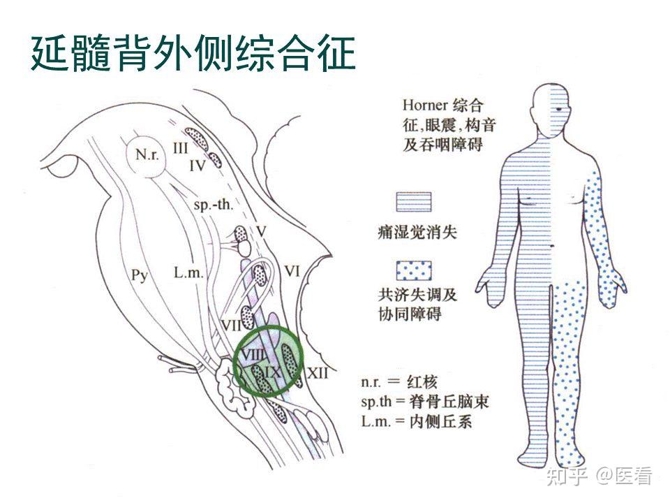 延髓位置图片