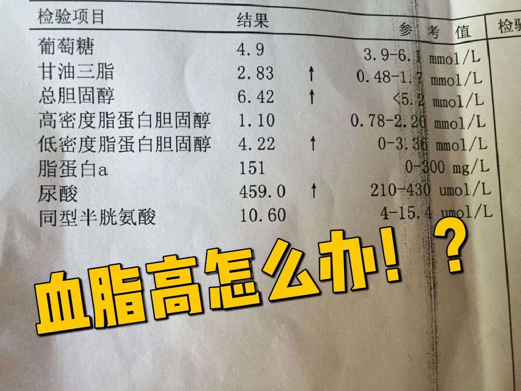 得了高血脂,3招让你巧降血脂 	 出现高血脂6大症状 	 1,胆固醇过高时