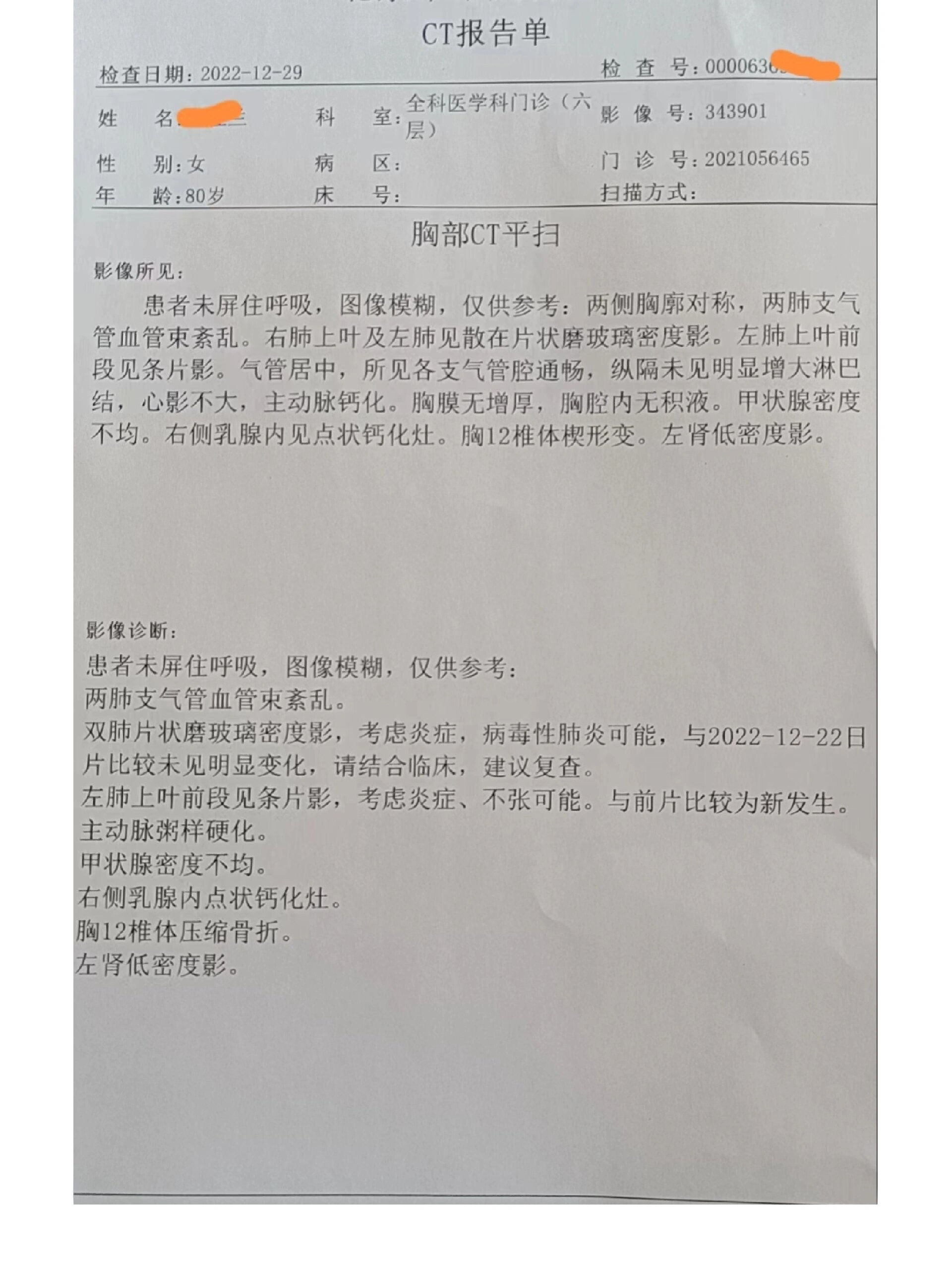 请胸外科专家和朋友们帮助看一下肺ct结果