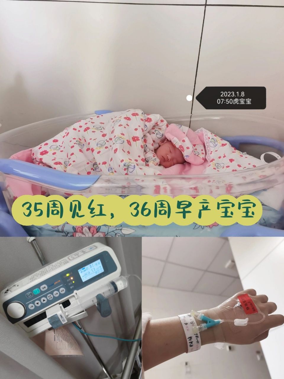 妇幼生产日记～见红36周早产宝宝顺产无侧切 预产期2.