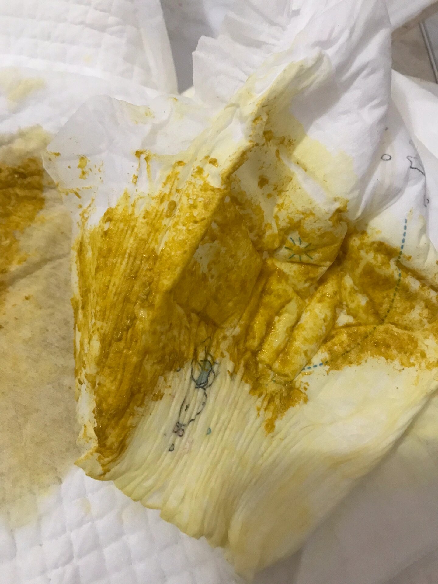 后面又是吃药又是换奶粉才好了. 五价轮状病毒疫苗,是一种预防