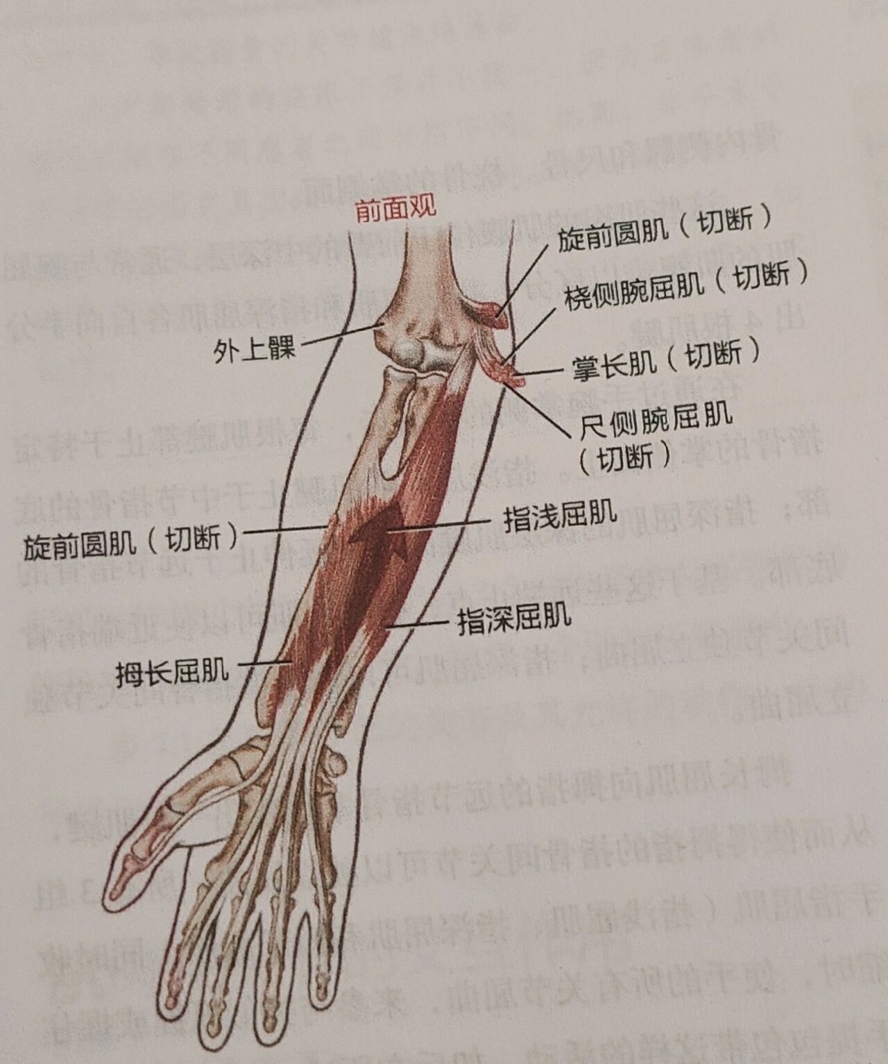 指屈肌