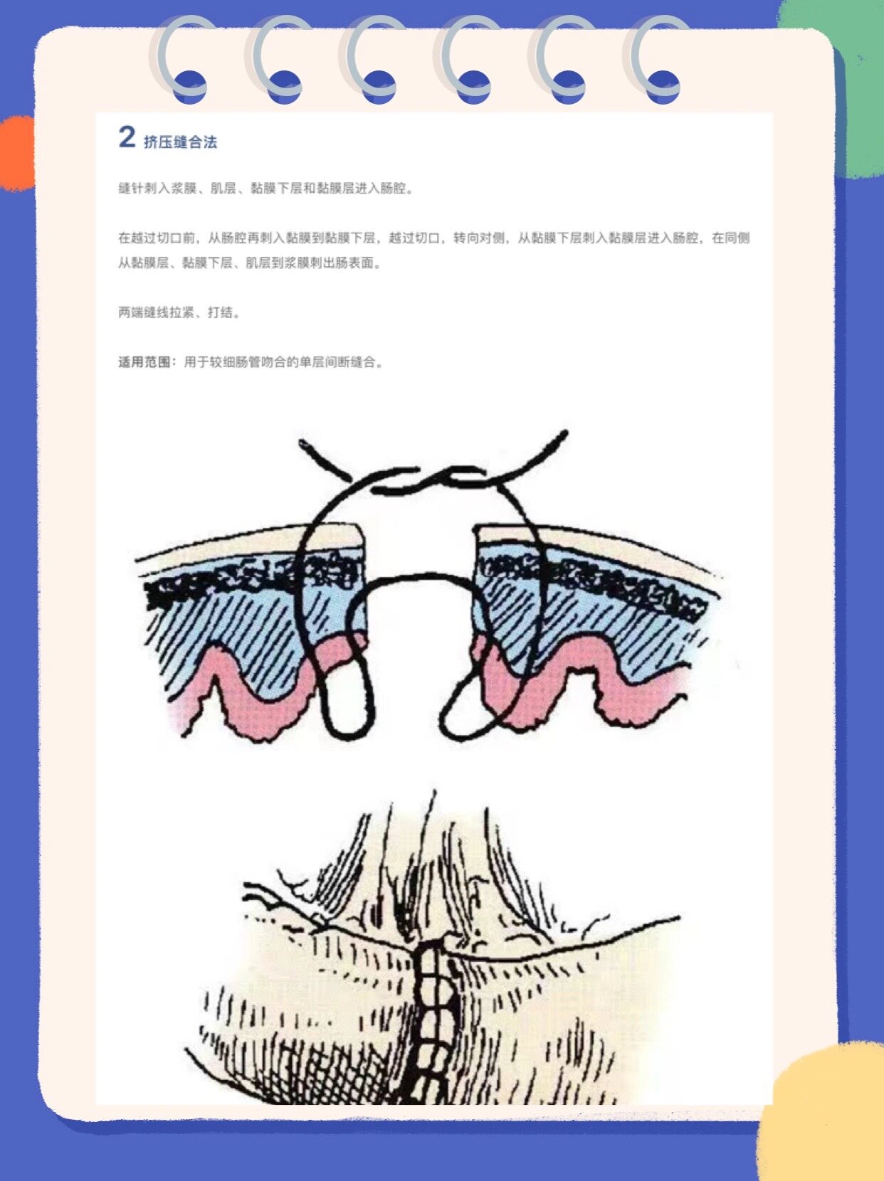 13种外科缝合方法