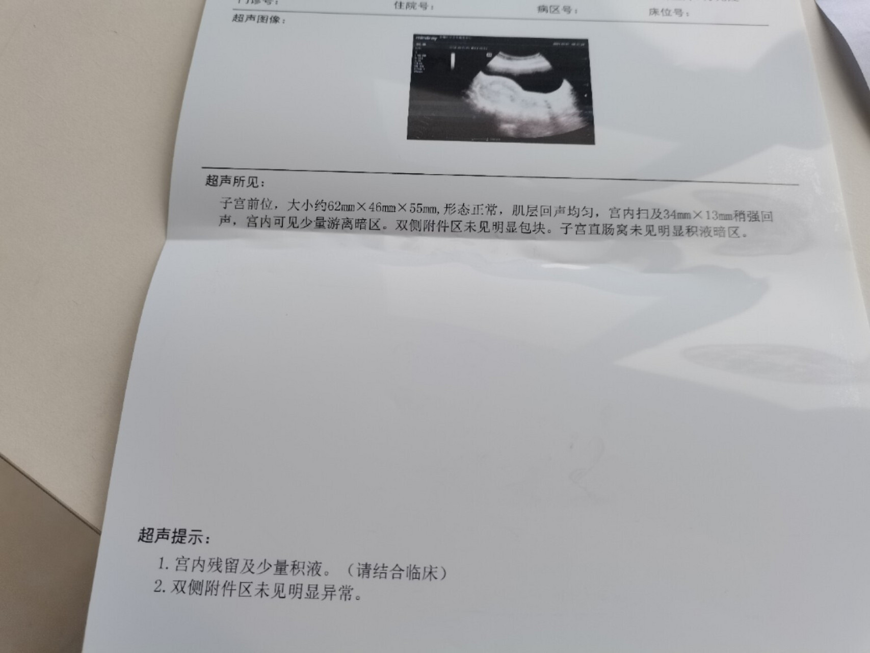 药流后残留物是什么样的,血丝血块是不是残留物