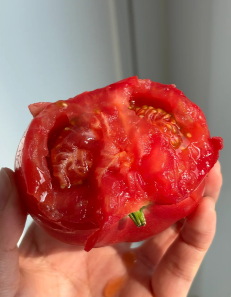 由于皮肤弹性纤维断裂,腿上可能出现红色条状痕迹.这属于正常现象