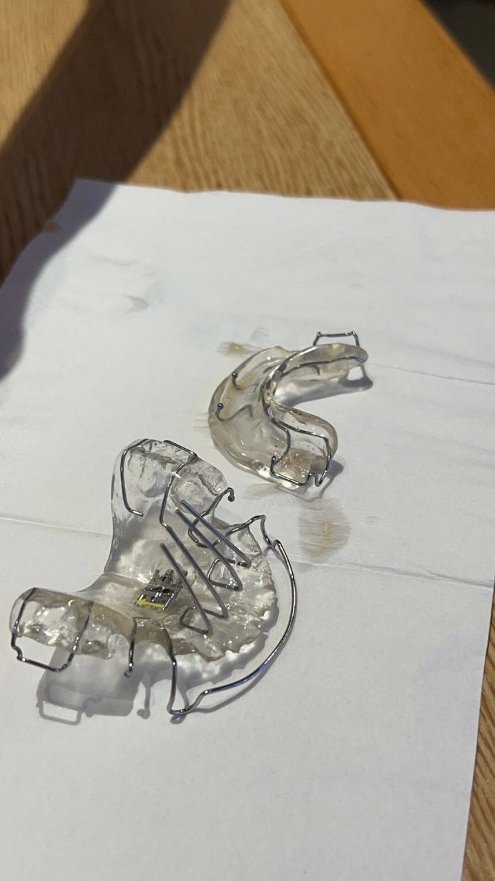 twin block(tb)矫正器价格,整牙之路开启 2023.8.