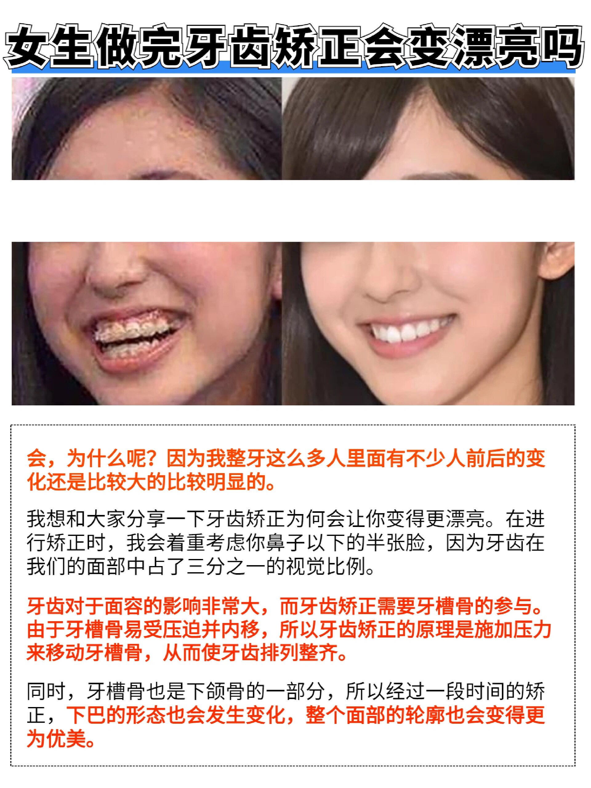 女生矫正牙齿后变美是怎样的体验?