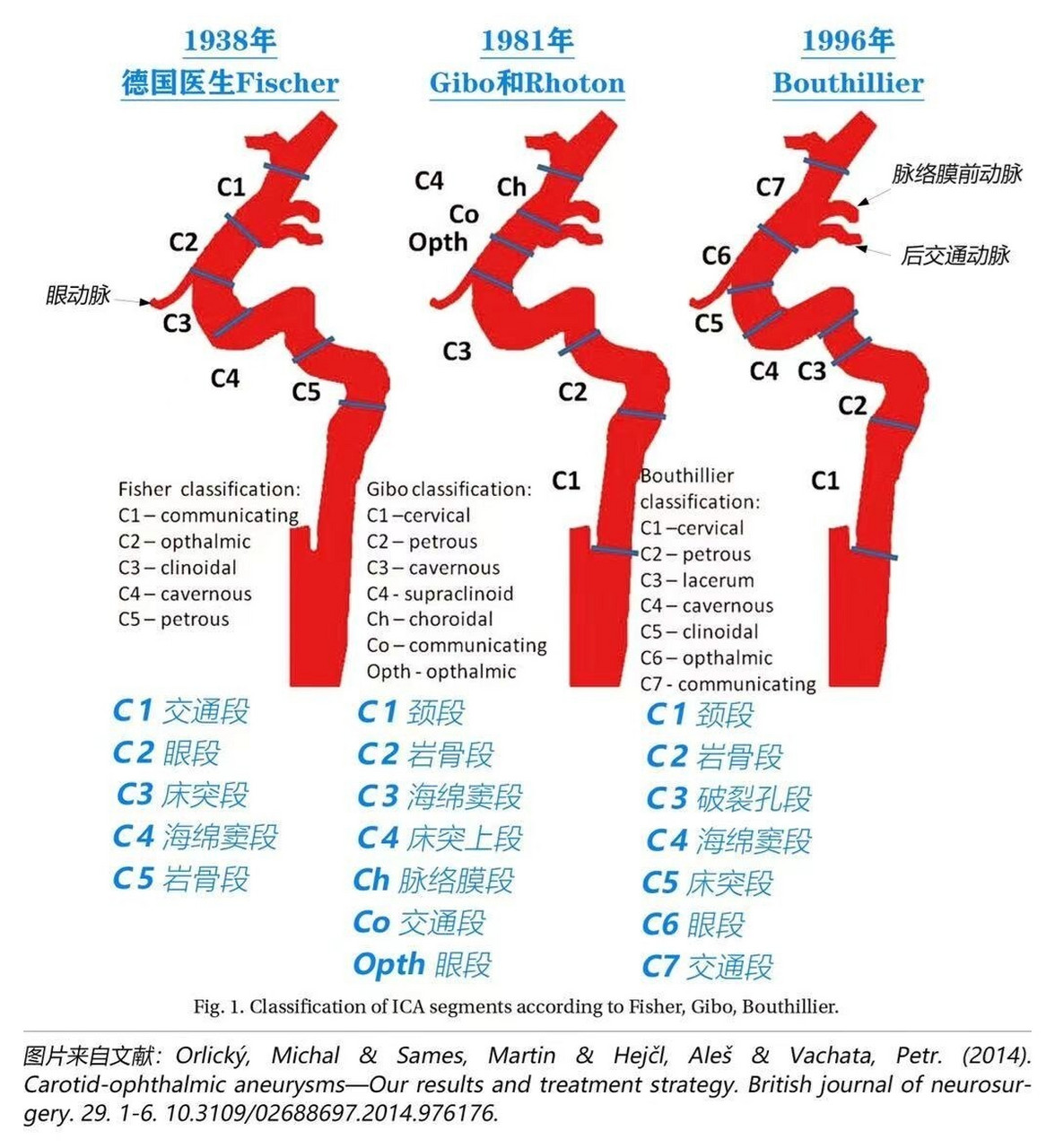 颈内动脉7分段示意图图片