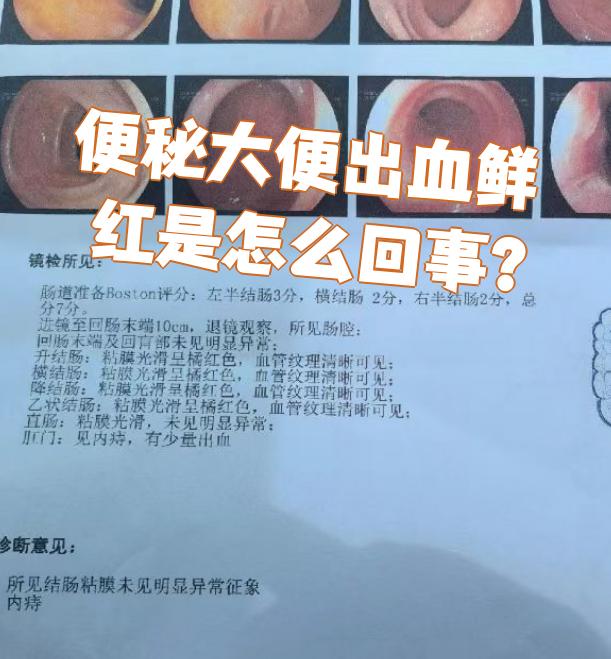 为什么每次拉屎都会出血但是不疼还有息肉为什么在线 为什么每次拉屎都会出血但是不疼还有息肉为什么在线