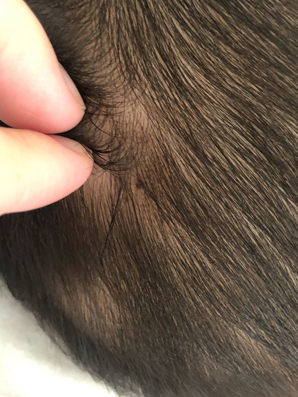 是色素痣吗.这几天去医院看看