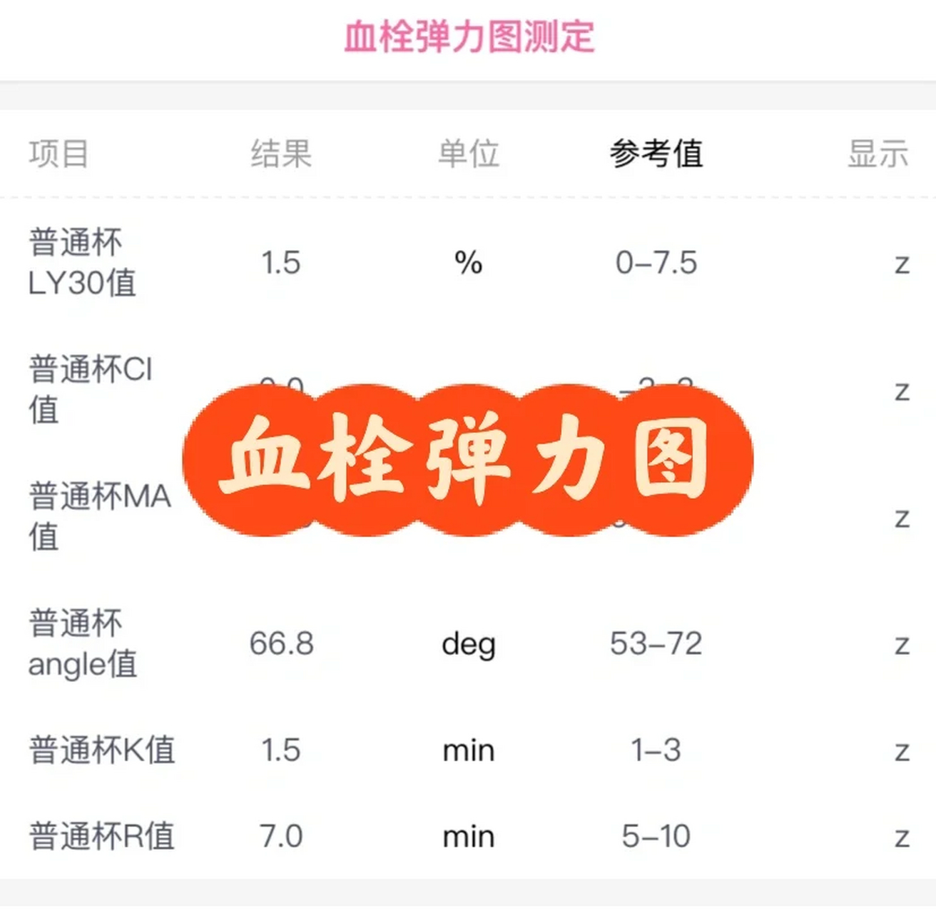 凝血检查之血栓弹力图 此贴我想分享一下我在备孕以及孕期做过的血栓