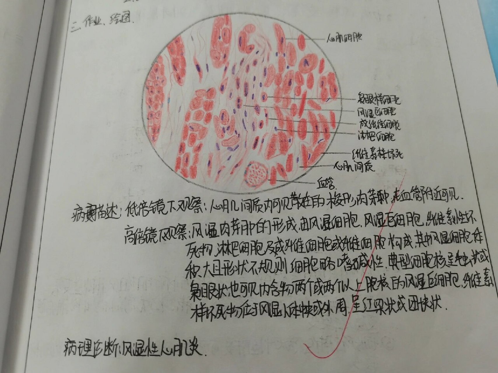 心肌细胞切片手绘图片