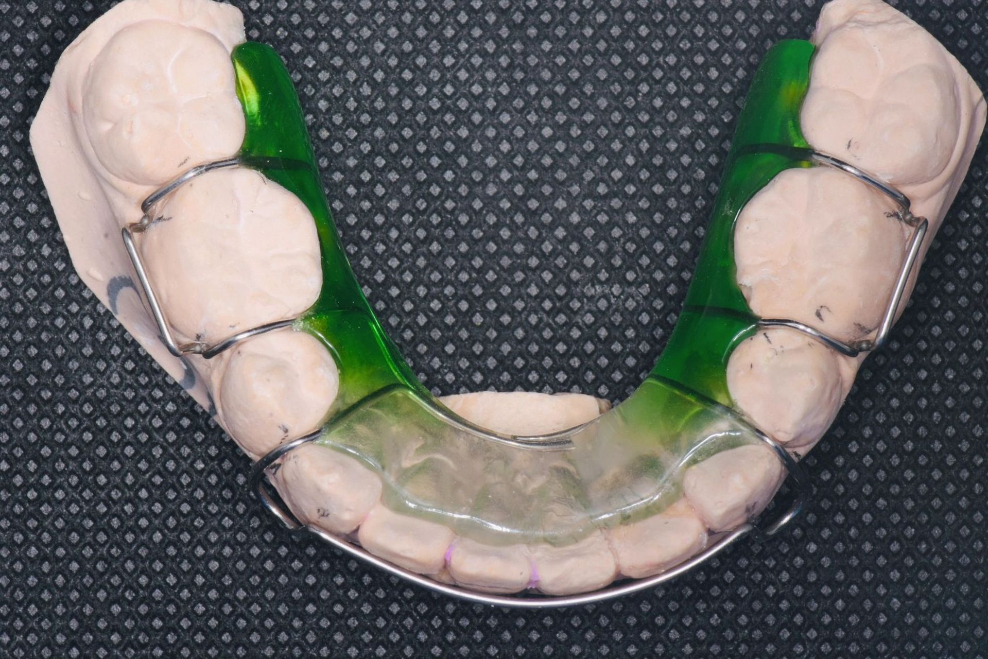 哈雷式保持器注意事项 — 全天佩戴 — 哈雷保持器应该全天佩戴,除了