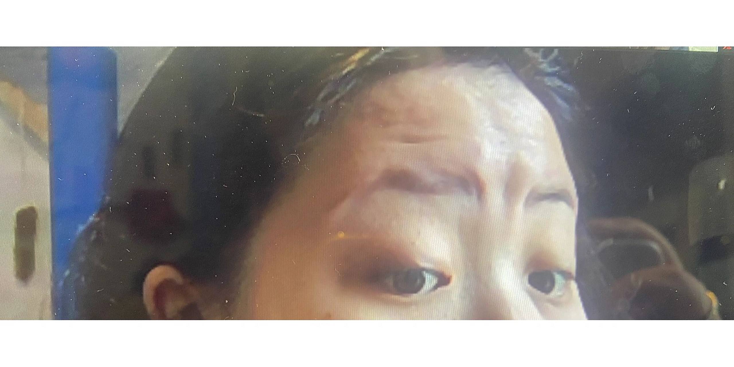 有没有姐妹和我一样,眉心凹陷?好丑哦, 该怎么改善?