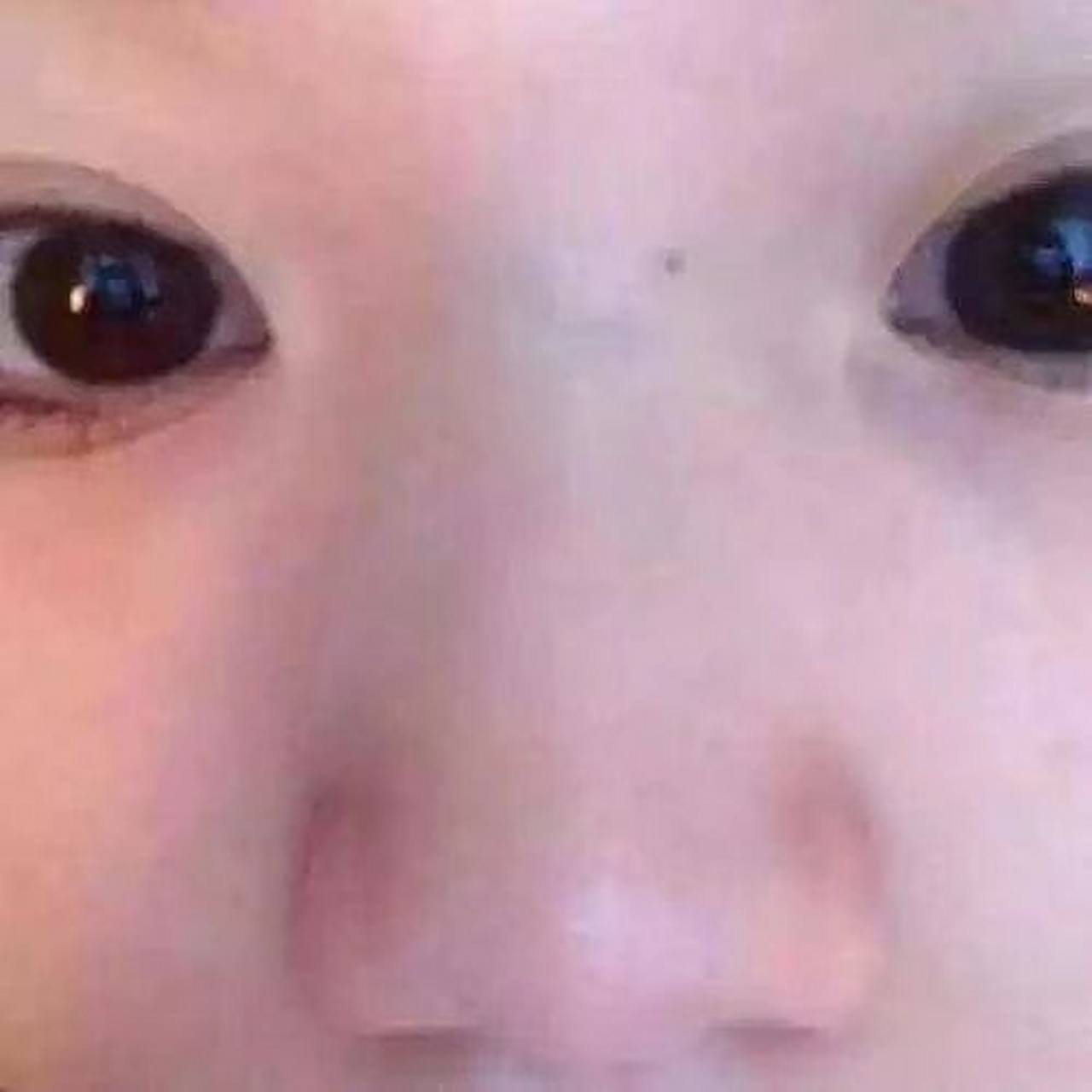 孩子两眼中间那一根青筋是怎么回事?