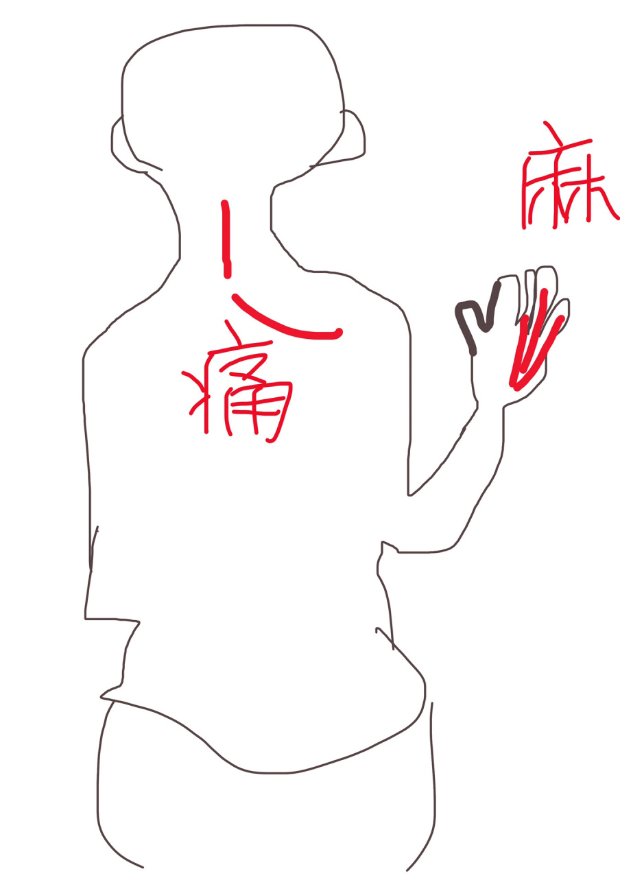 颈椎痛,右手三个手指发麻 谁懂我的痛苦 去年九月就痛了一个月,现在又