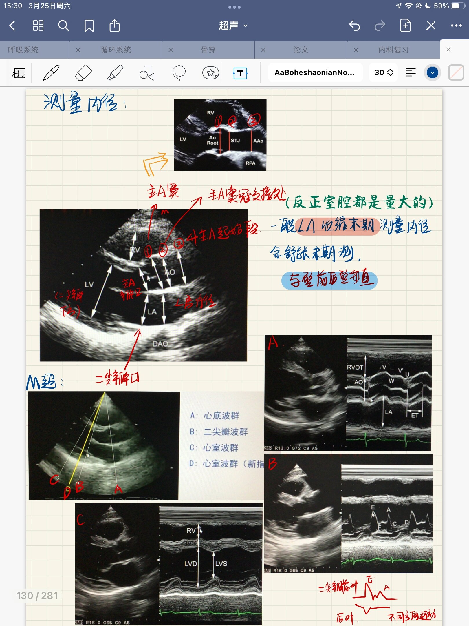 如何看懂心脏彩超图图片