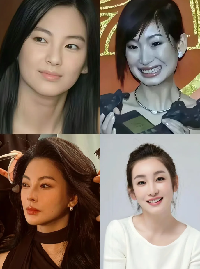 其他人先不说,下面列举几个明星例子: 1,张雨绮