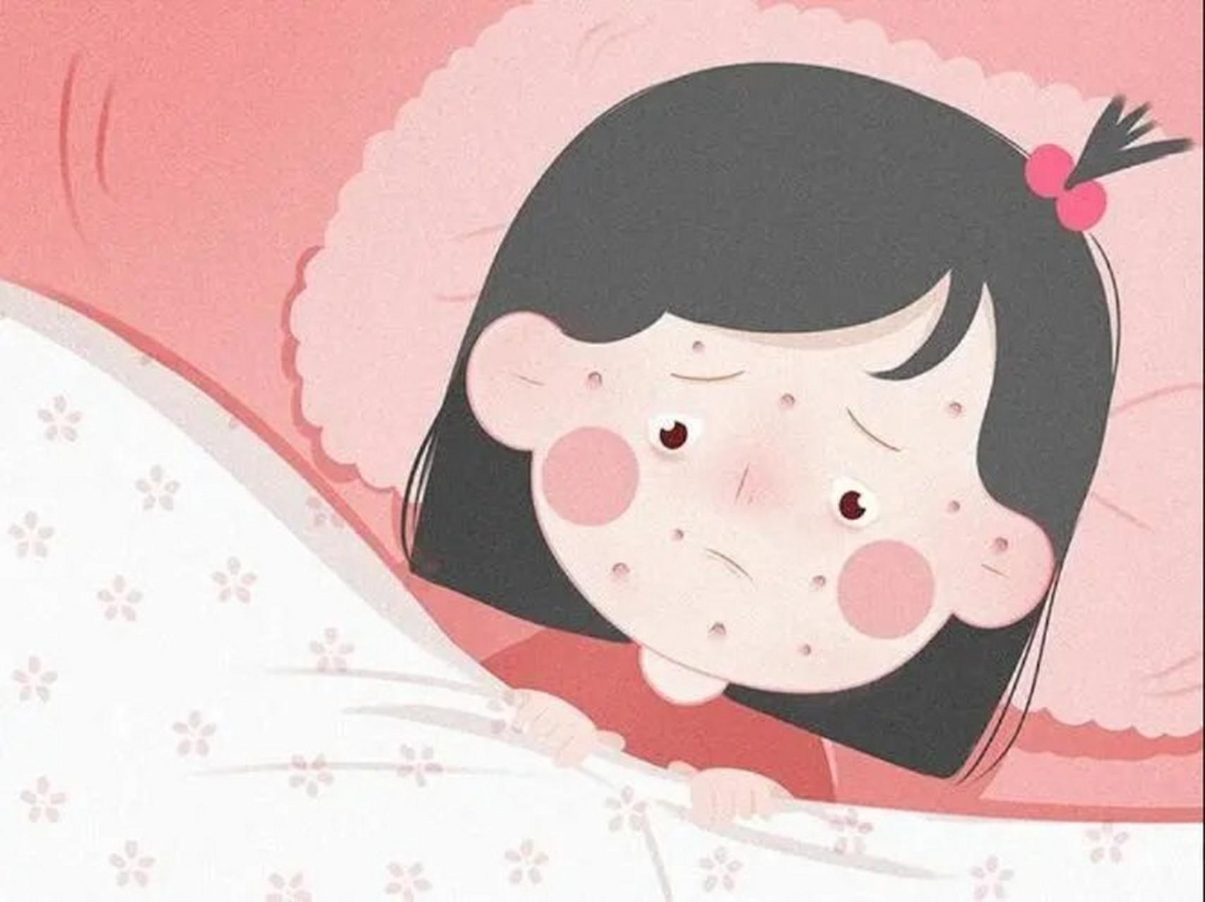 水痘高发期,请随时做好战"痘"准备 98什么是水痘 水痘是由水痘-带状