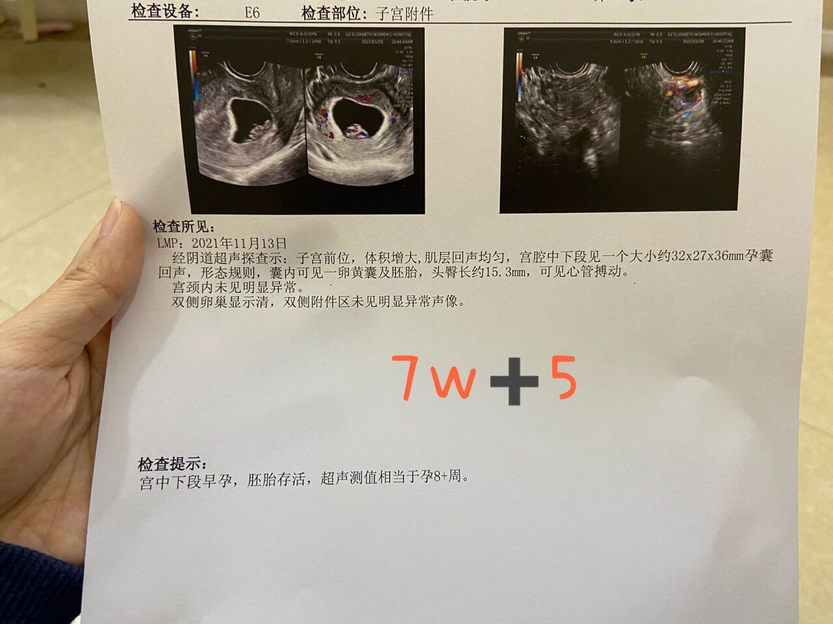 怀孕就是过五关斩六将,孕早期三周内已经做了三次b超了.