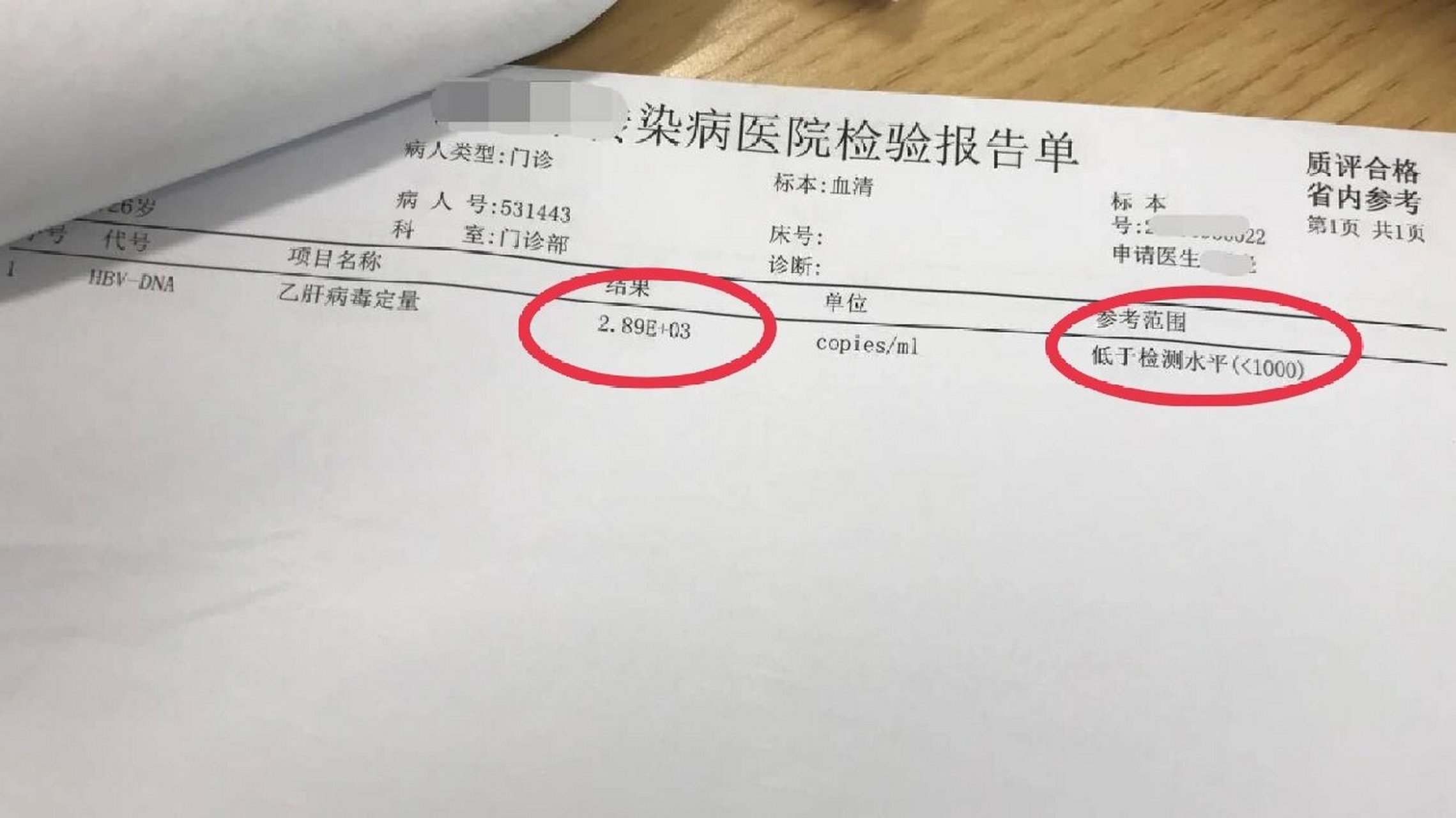 乙肝病毒dna定量图片图片