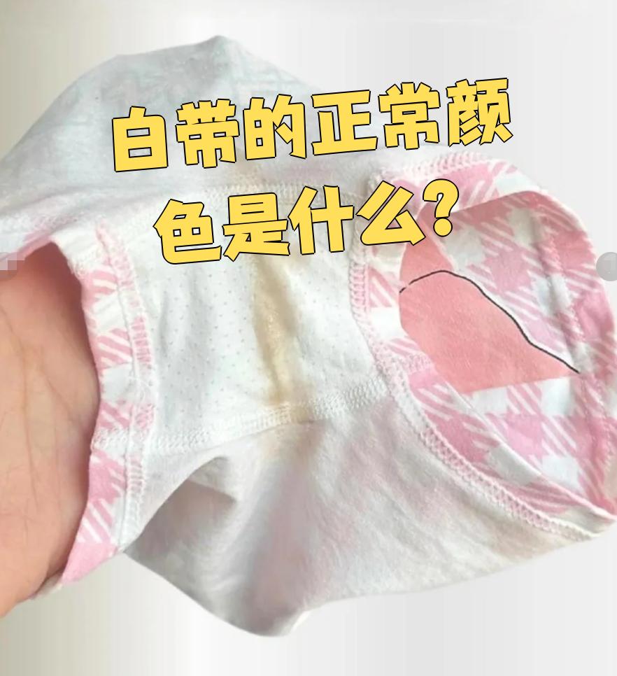 正常的白带颜色是白色或透明的