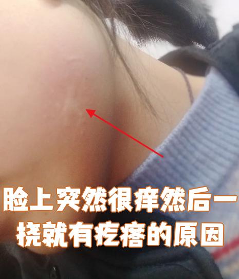 为什么脸上会痒痒的