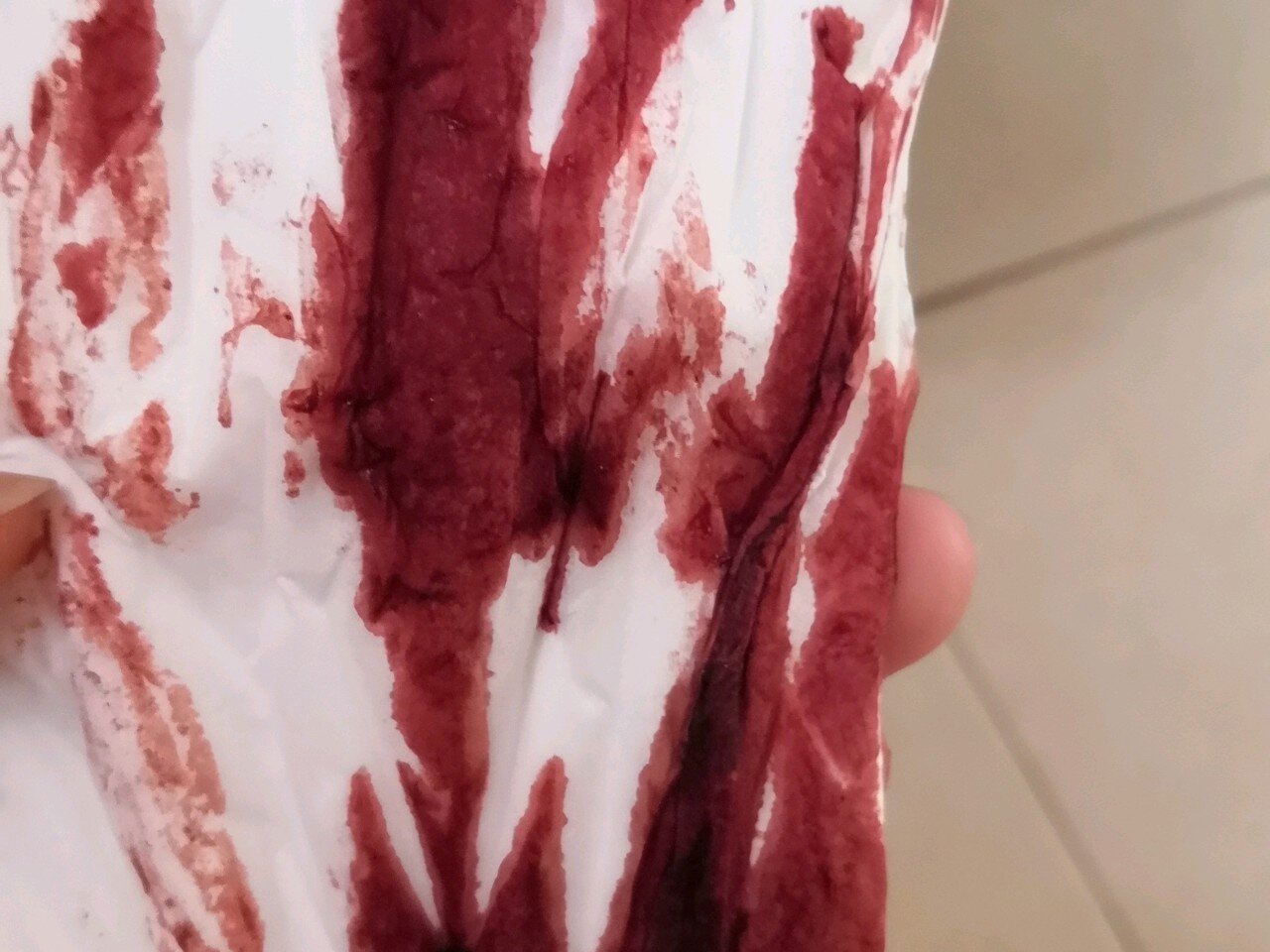 孕14周大出血,不要怕,慎入