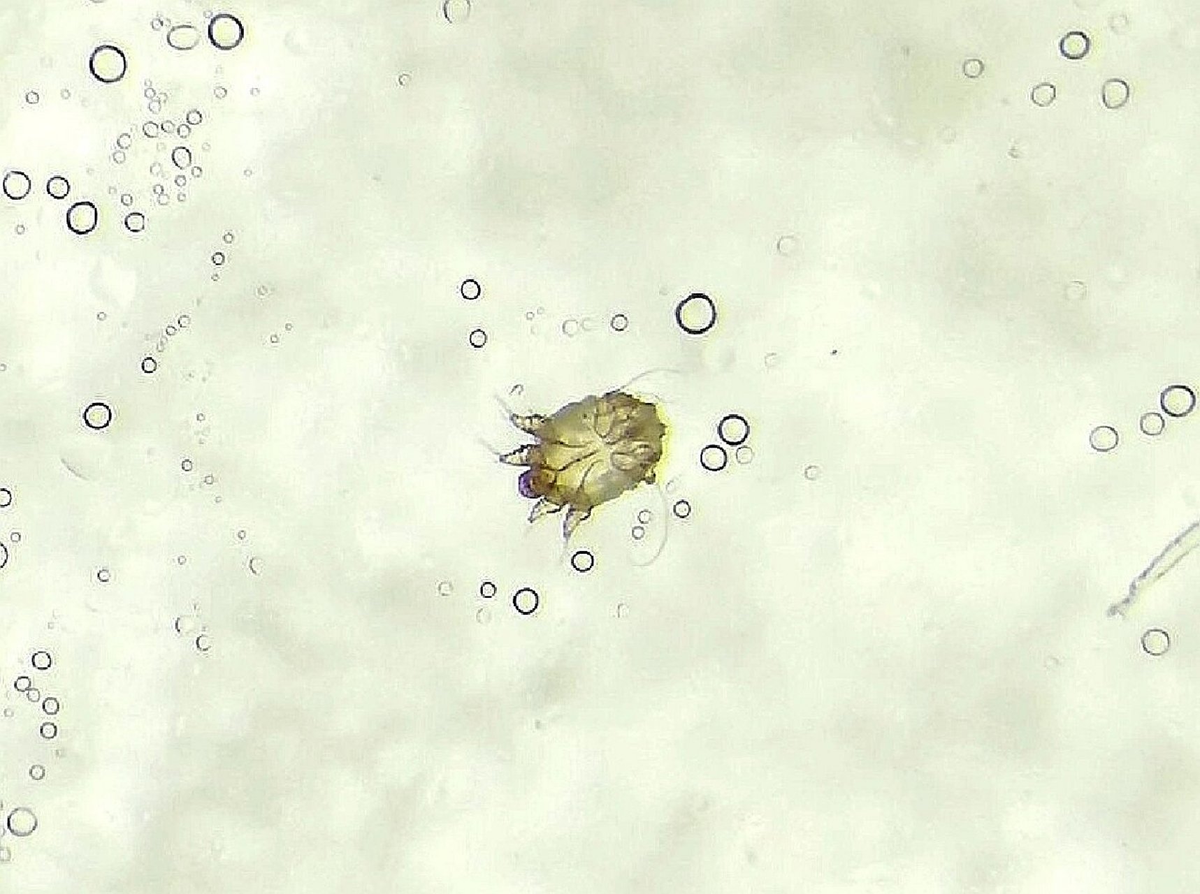 体视显微镜下的疥螨ssa
