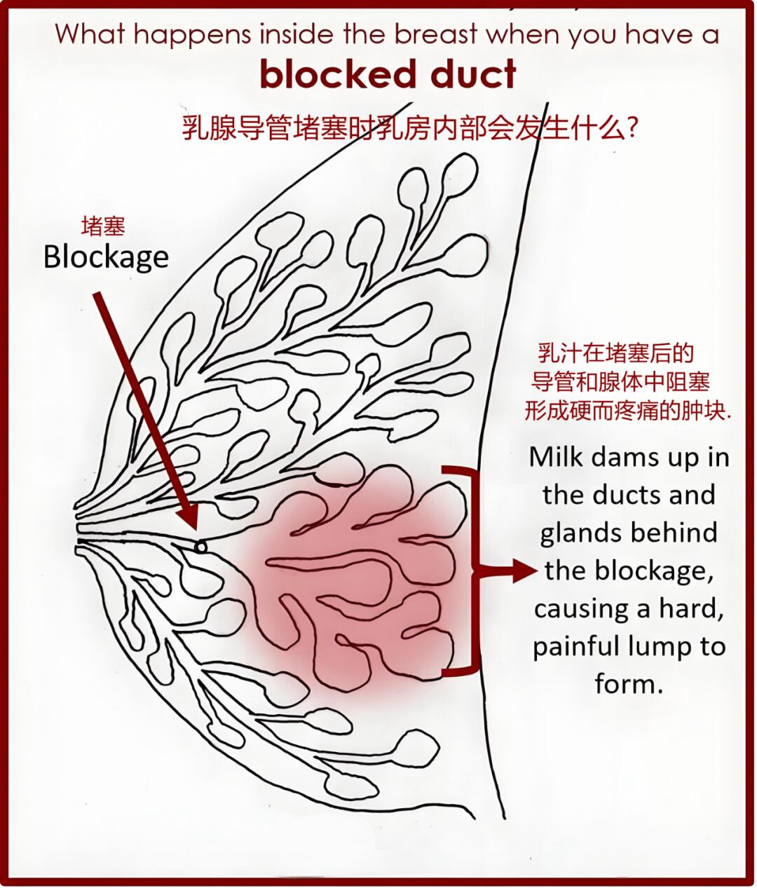 输乳管图片