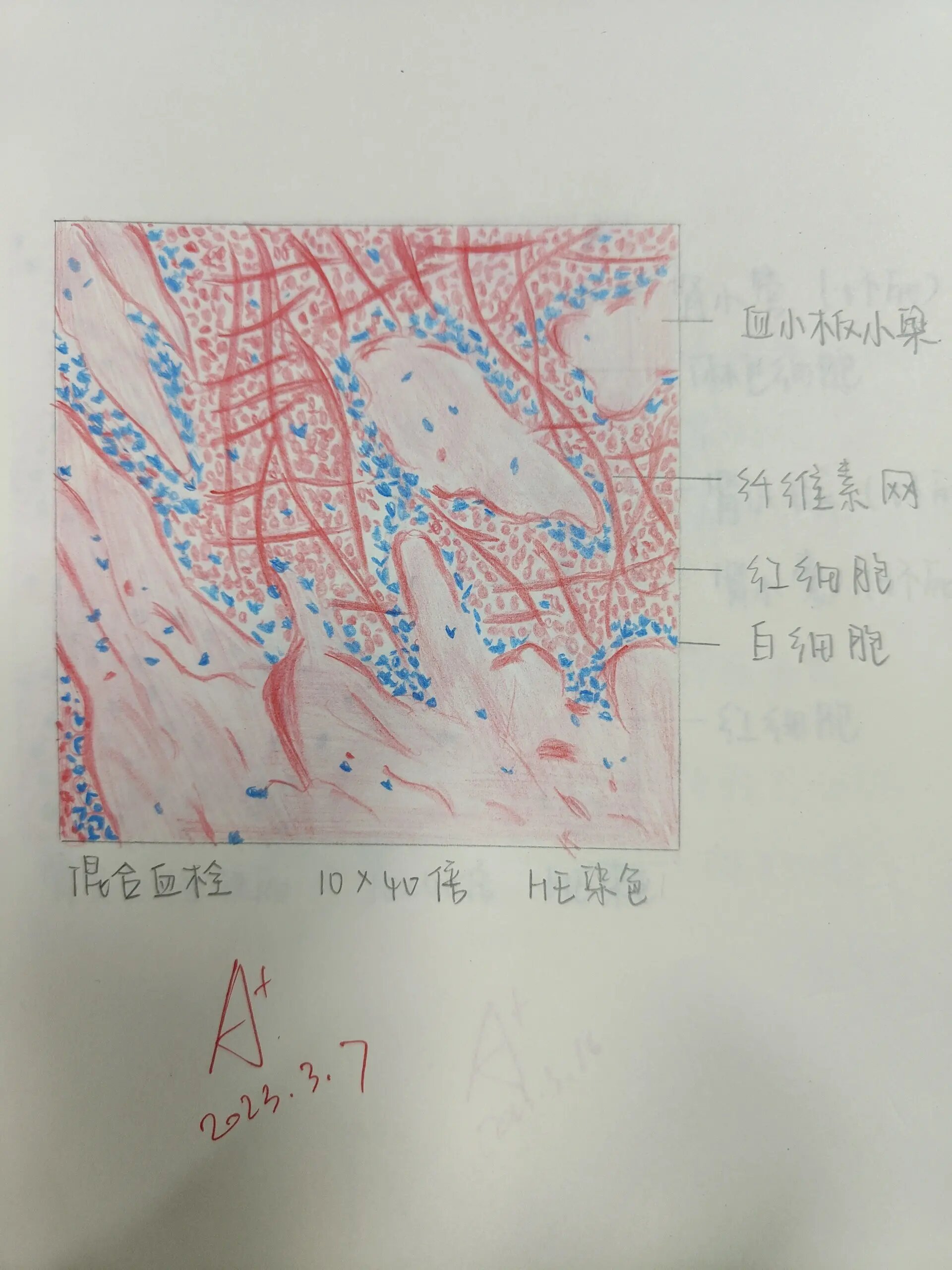 肥大细胞手绘图图片