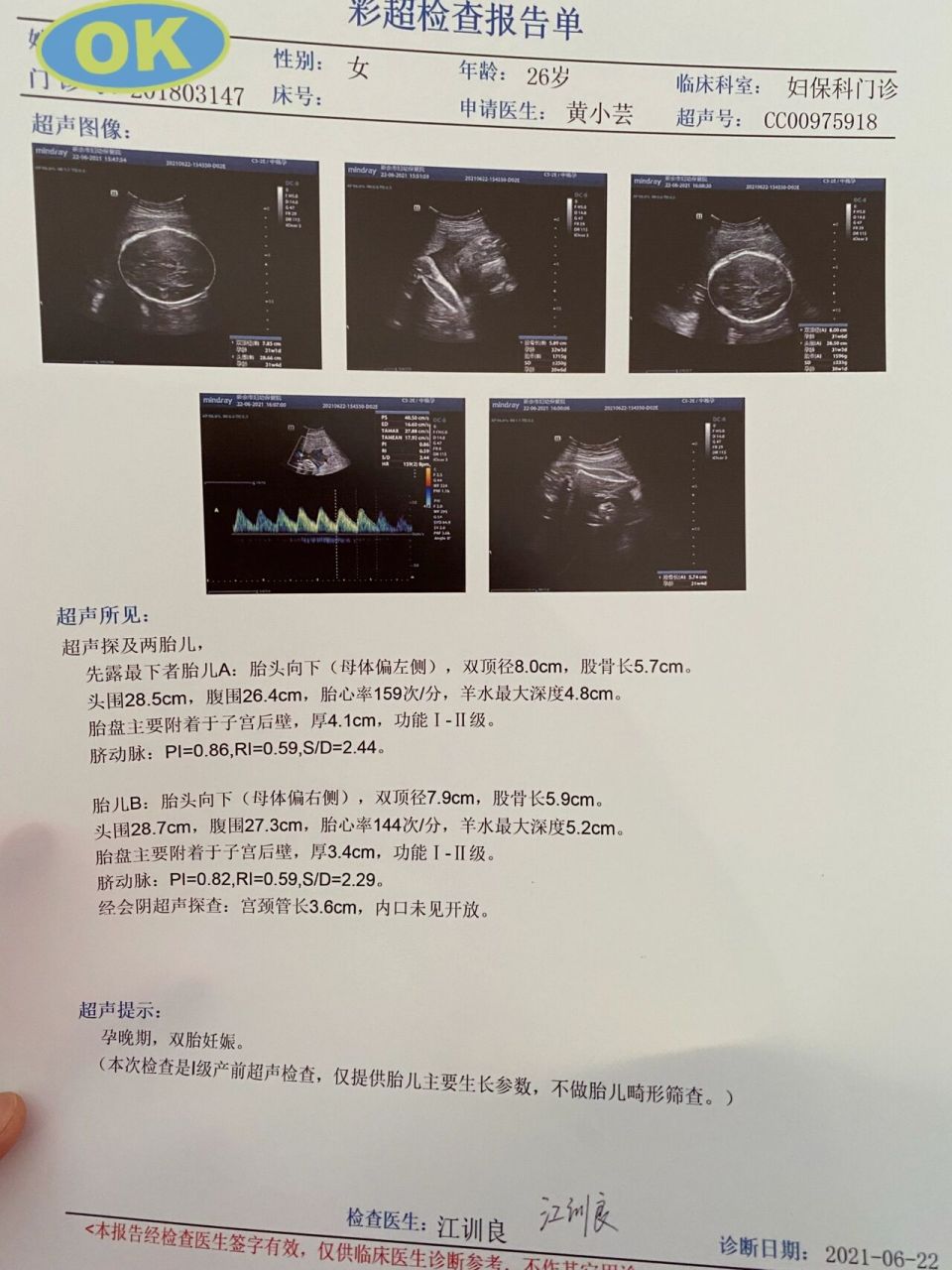 双胞胎彩超图图片