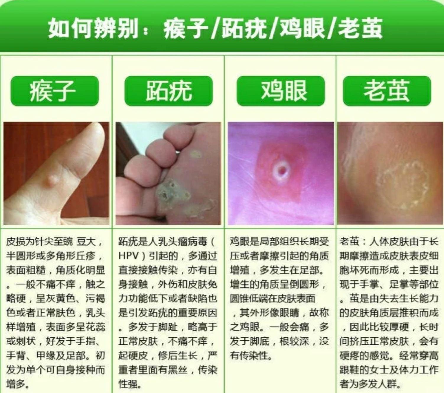 感染引起的,这种病毒会让皮肤过度角化,形成