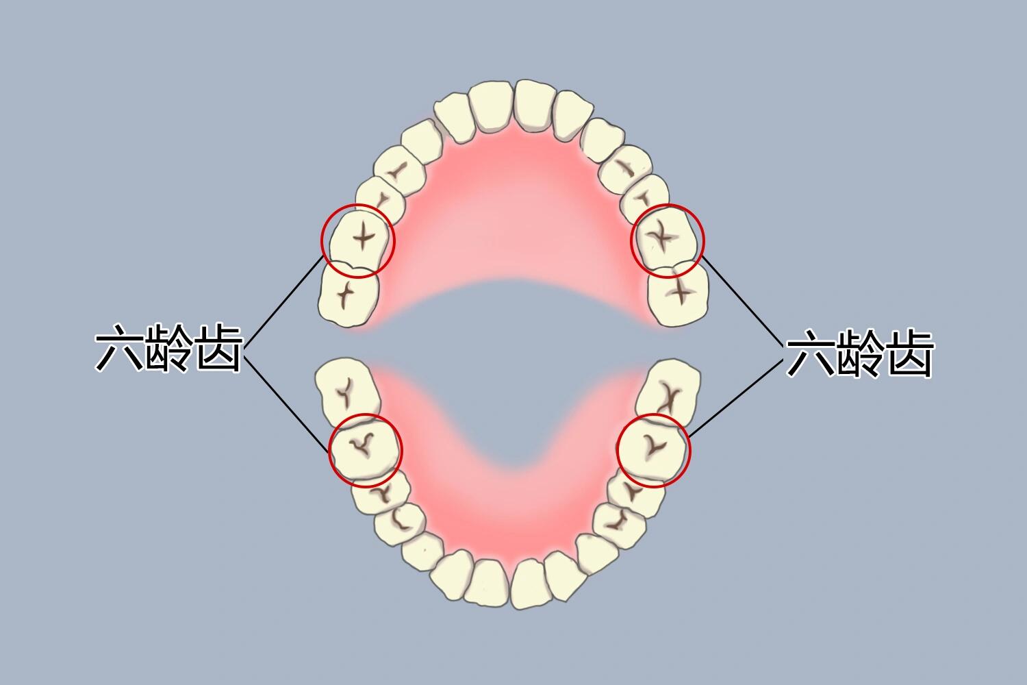 六龄齿 儿童到了6周岁,在牙列的最后面即在第二乳磨牙的后面萌出的牙