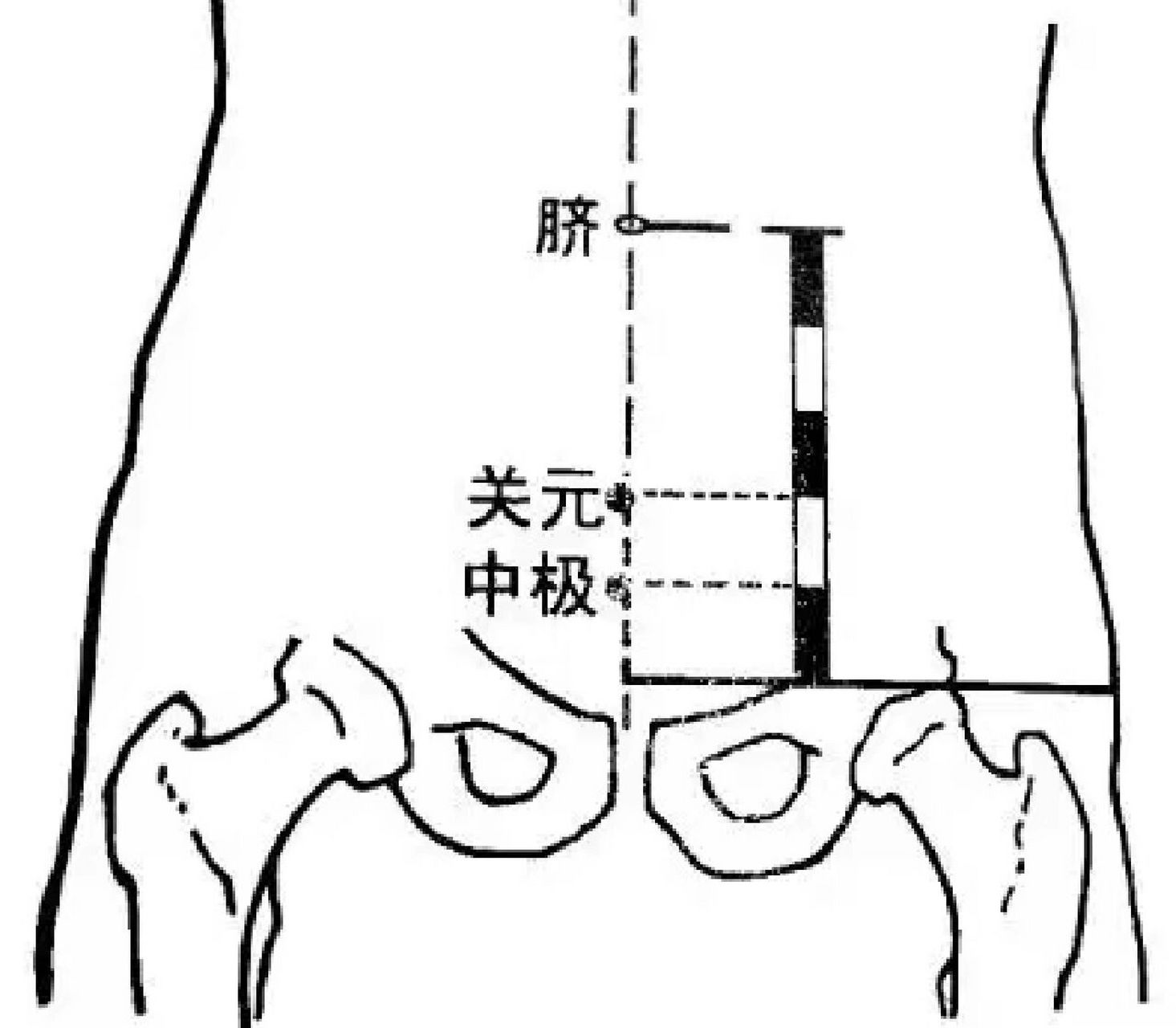 极穴 每日一穴 中极穴(治尿潴留,小便异常多按中极) 【位置】在下腹部