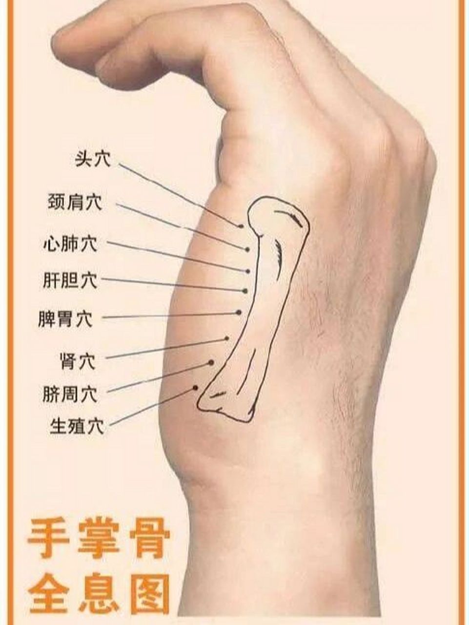 第五掌骨基底部位置图图片