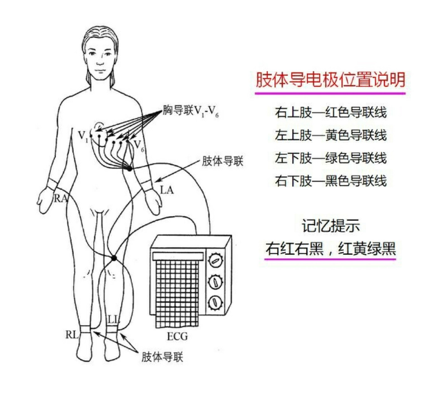 做心电图的各个位置