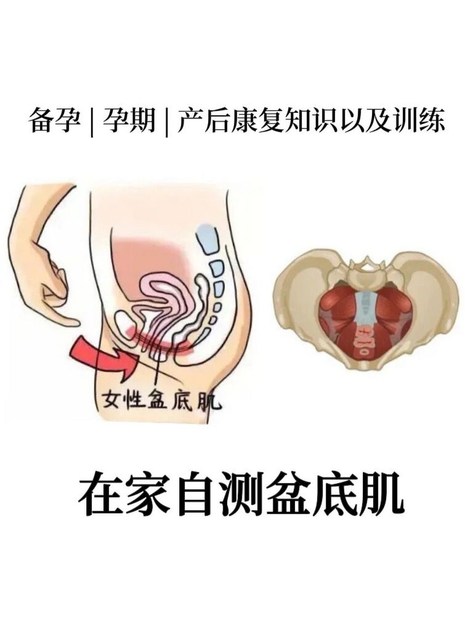 10分钟掌握居家自测盆底肌方法get�盆底功能障碍常见的症状