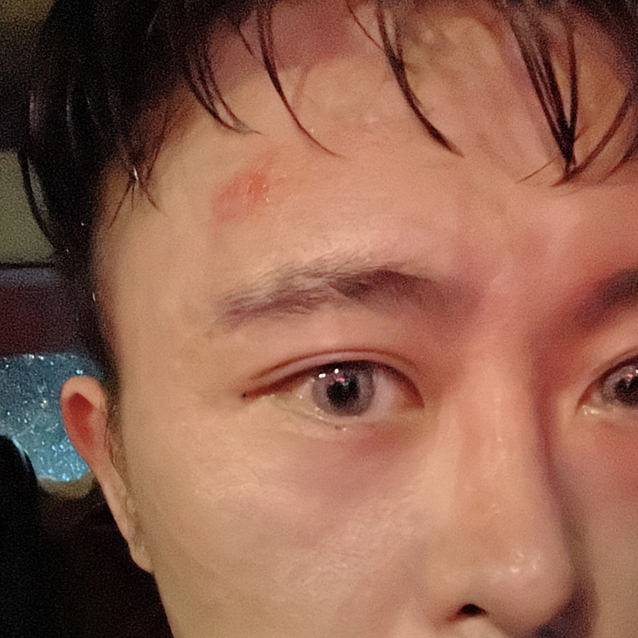 得,今天踢球破相了,脸落地