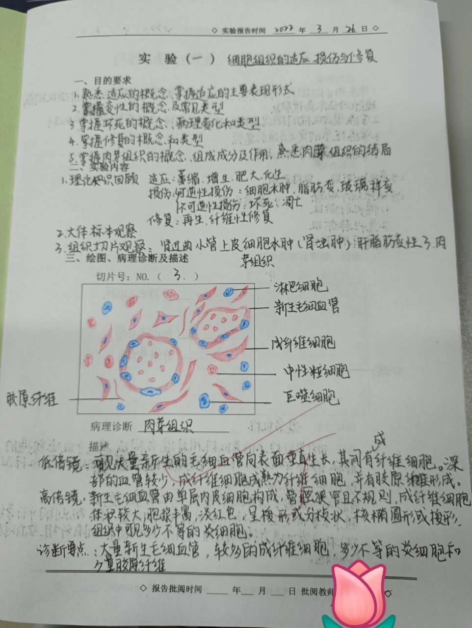 病理学实验报告——红蓝铅笔绘图 镜下观 p1肉芽组织 p2混合血栓 p3