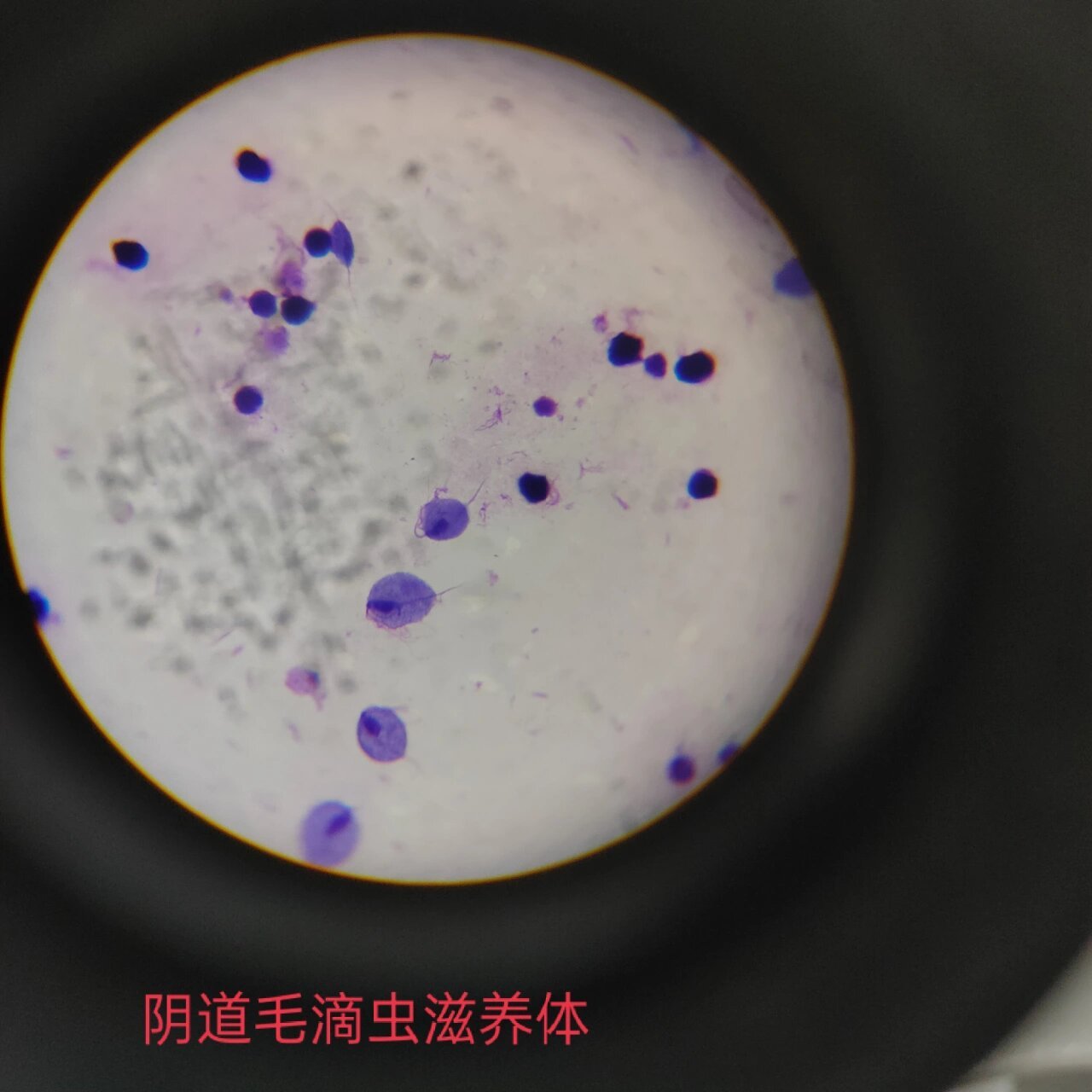 医学原虫镜下观察 ①溶组织内阿米巴包囊 (感染期为四核包囊,二分裂)