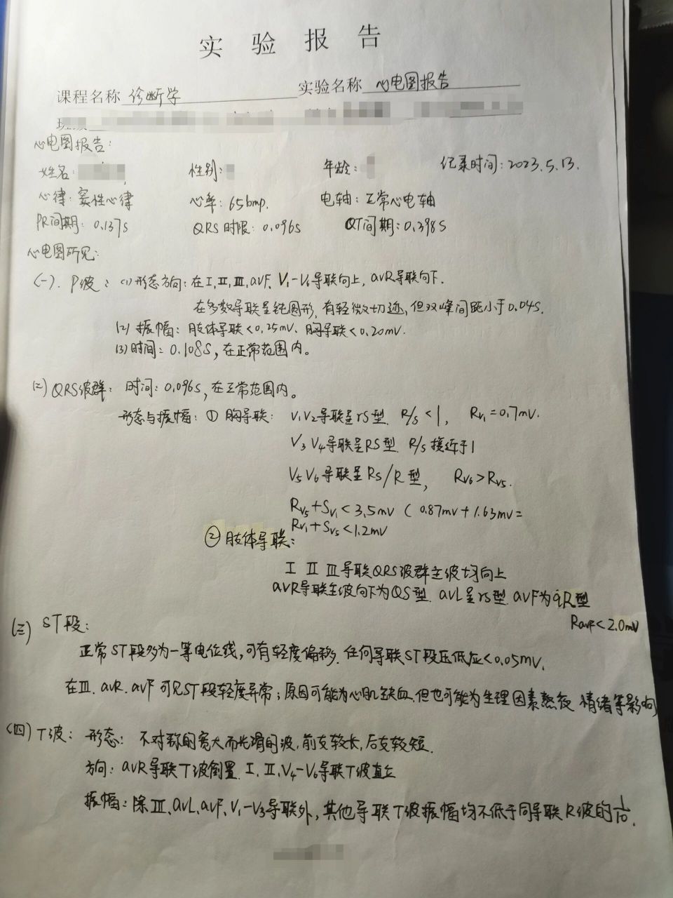 诊断学 心电图实验报告