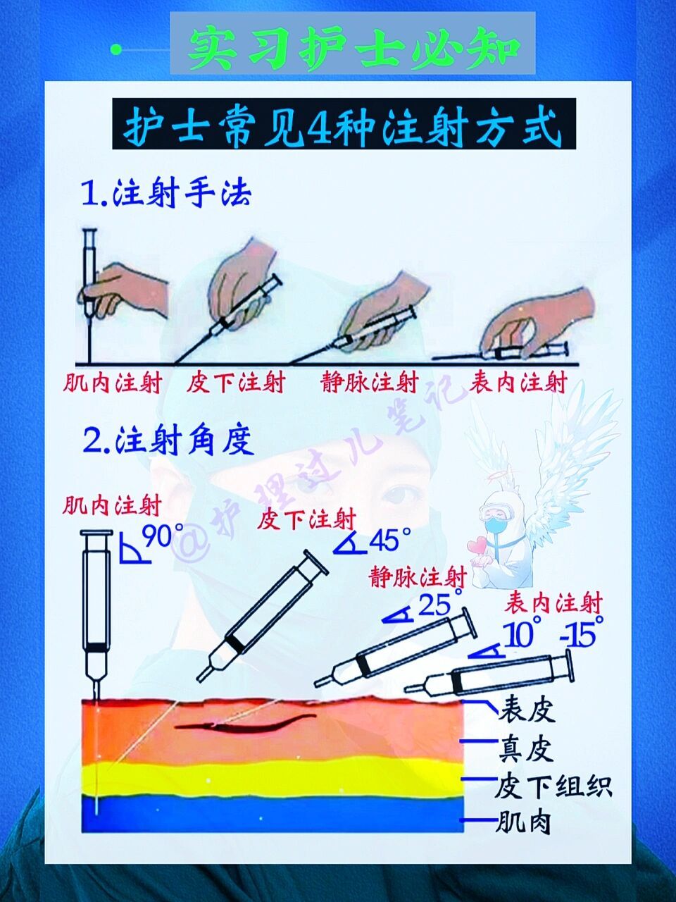 97一张图学会73护士常见4种注射方式6015 实习护士97实习