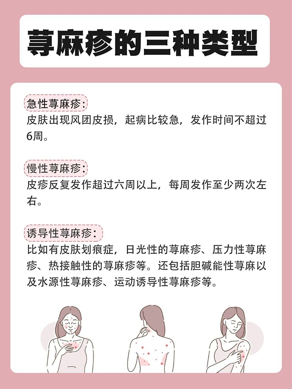 荨麻疹是皮肤方面非常常见的问题,荨麻疹的症状级别都了解一下!