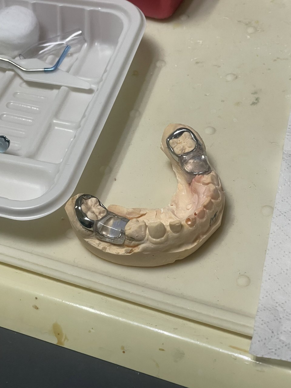 关于儿童牙齿的间隙保持器 等了一周之后,我淘的"小假牙"模型终于好了