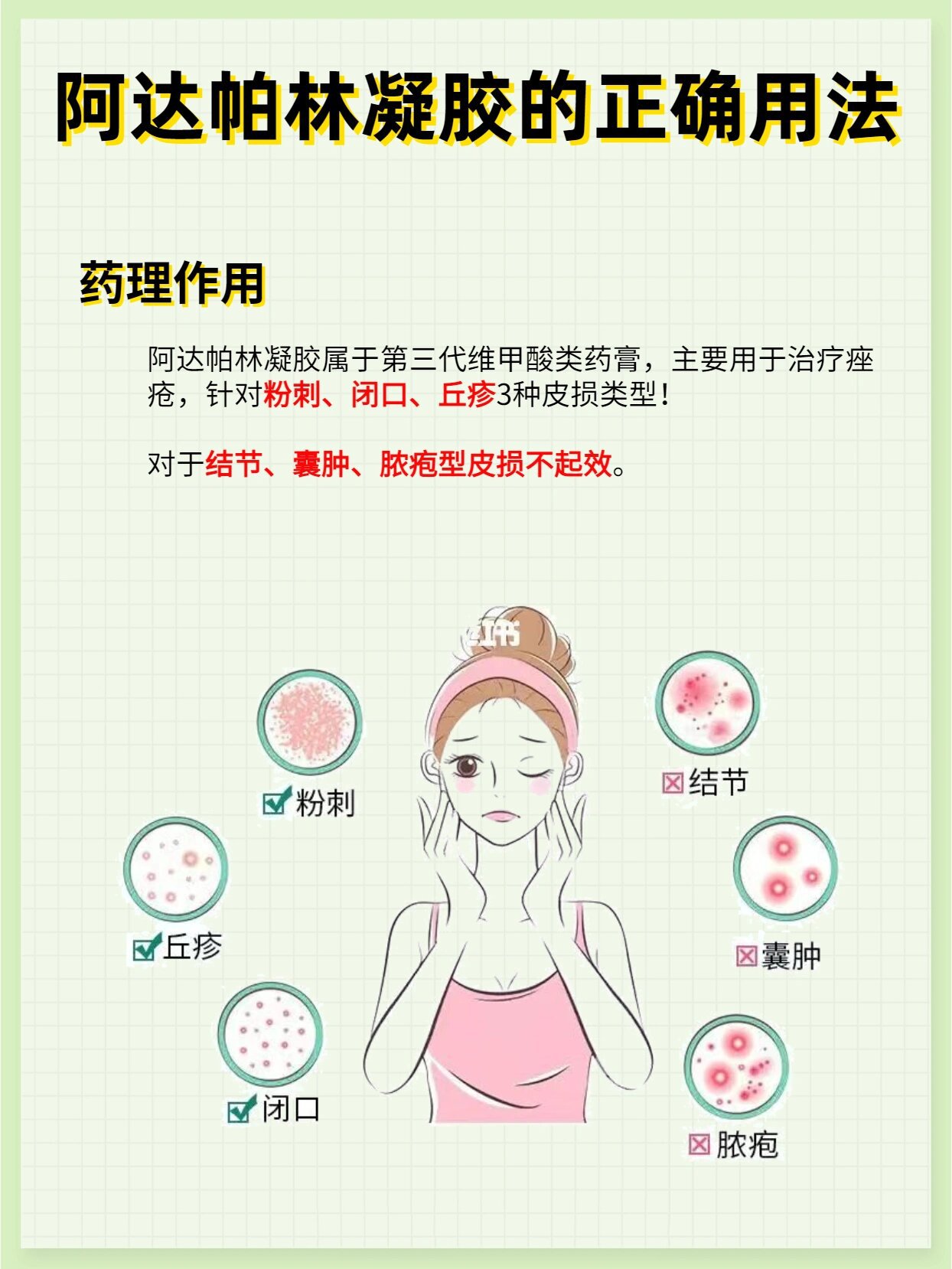 平价祛痘药膏75阿达帕林凝胶的正确使用方式