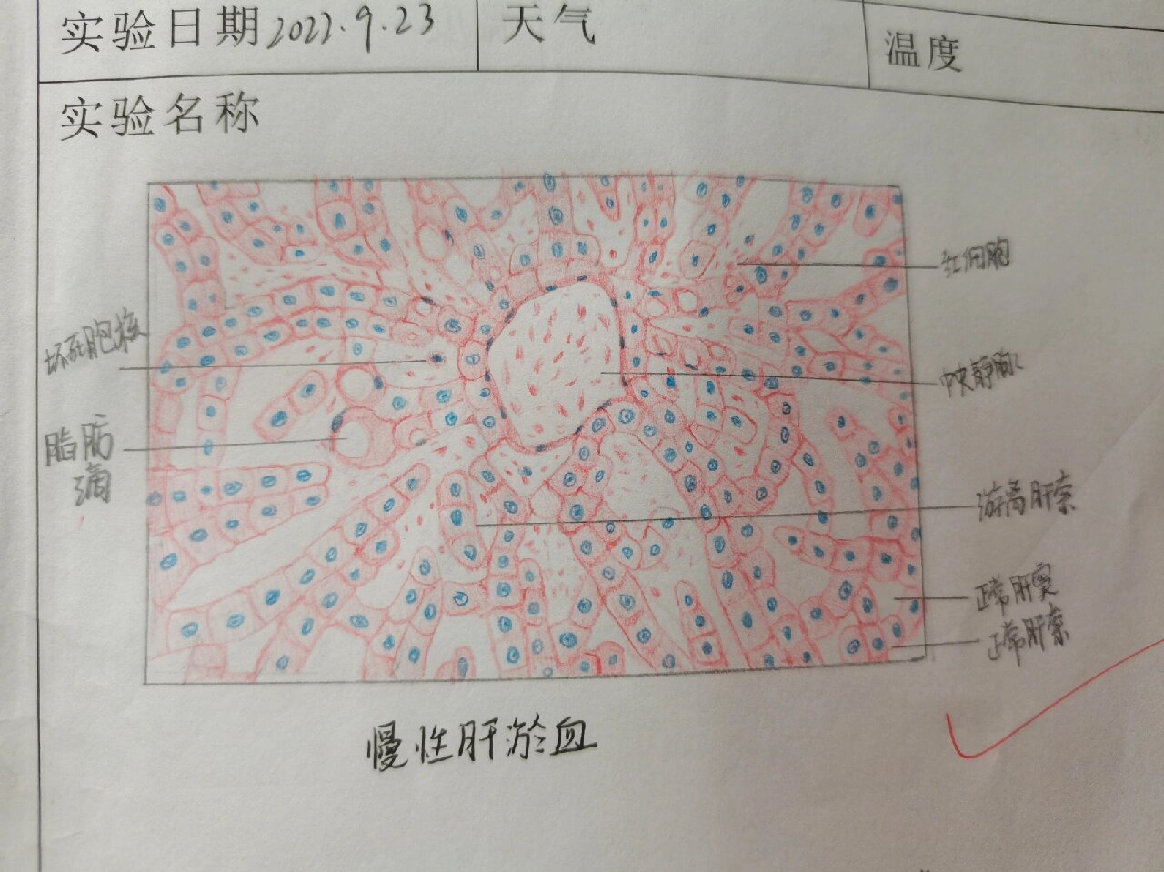 血栓图手绘图图片