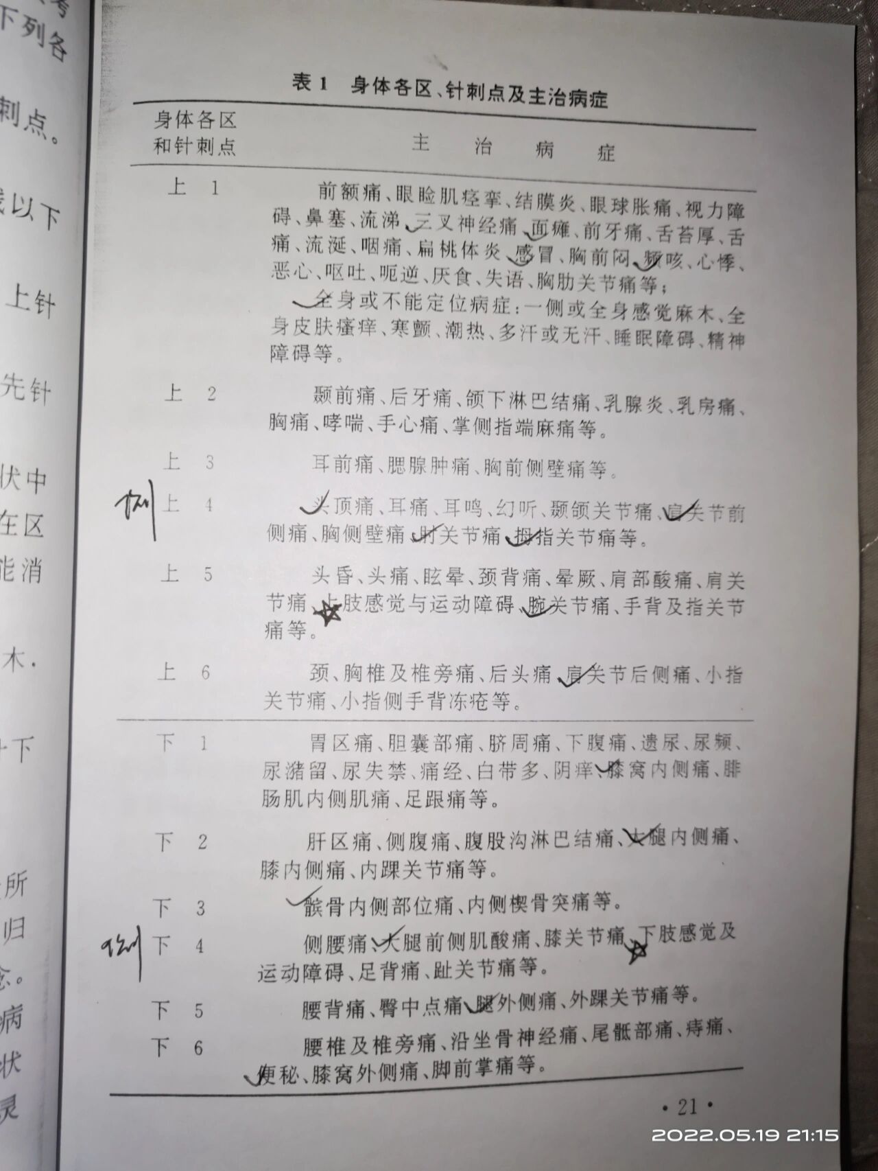 腕踝针分区及对应症状